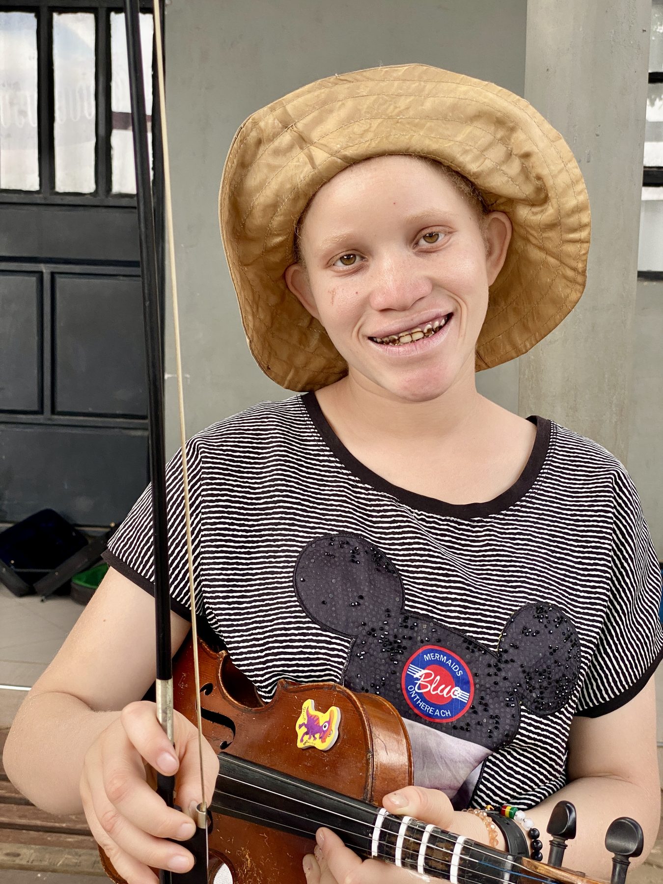Child with albinism holding a violin at the Living Water Children Center, Arusha